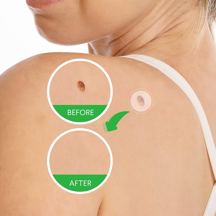 Skin Care Patches – 36 Pack Adhesive Patches for Personal Care