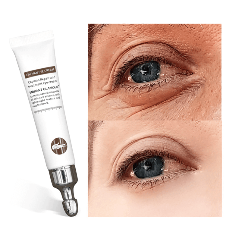 Eye Cream – Lightweight Under-Eye Moisturizing Cream